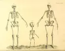 Skeleton24i.webp